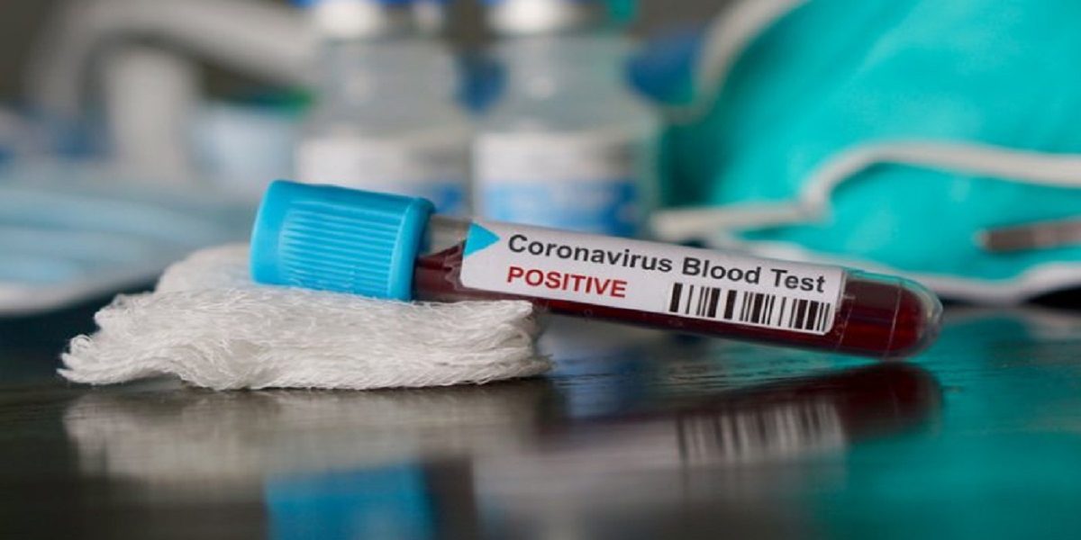 Returnee From South Sudan Tests Positive For Coronavirus